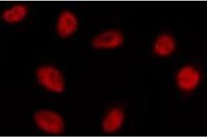 ABIN6275189 staining HepG2 by IF/ICC. (EMX1 antibody  (Internal Region))