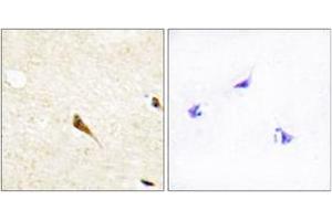 Immunohistochemistry analysis of paraffin-embedded human brain tissue, using MOK Antibody. (MOK antibody  (AA 261-310))