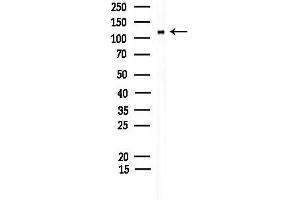 anti-CAP-GLY Domain Containing Linker Protein 2 (CLIP2) (C-Term) antibody