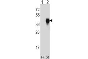 Western Blotting (WB) image for anti-Plasminogen Activator, Urokinase Receptor (PLAUR) antibody (ABIN3003728) (PLAUR antibody)