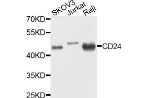 Western blot analysis of extracts of various cells, using CD24 antibody.