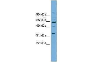 WB Suggested Anti-WNT8B Antibody Titration: 0. (WNT8B antibody  (N-Term))