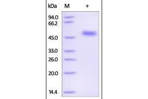 Human Serpin F1, His Tag on SDS-PAGE under reducing (R) condition. (PEDF Protein (AA 20-418) (His tag))