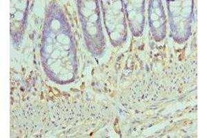 Immunohistochemistry of paraffin-embedded human colon tissue using ABIN7145996 at dilution of 1:100 (CCL28 antibody  (AA 20-127))
