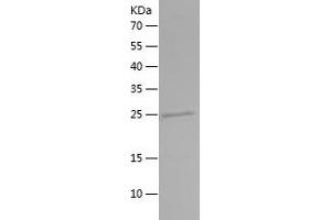 Western Blotting (WB) image for Secreted phosphoprotein 1 (SPP1) (AA 28-61) protein (His-IF2DI Tag) (ABIN7282501) (Osteopontin Protein (AA 28-61) (His-IF2DI Tag))