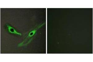 Immunofluorescence analysis of HeLa cells, using ICK Antibody.