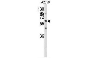Western blot analysis of CNTN1 Antibody (Center) in A2058 cell line lysates (35µg/lane). (Contactin 1 antibody  (Middle Region))