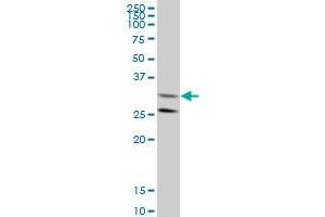 GGPS1 monoclonal antibody (M08), clone 1C3 Western Blot analysis of GGPS1 expression in HeLa (GGPS1 antibody  (AA 201-300))