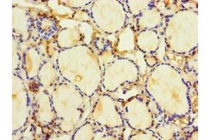 Immunohistochemistry of paraffin-embedded human thyroid tissue using ABIN7155301 at dilution of 1:100 (HDAC1 antibody  (AA 1-482))