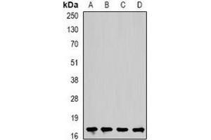 Western blot analysis of Cofilin 2 expression in Hela (A), mouse heart (B), rat kidney (C), rat brain (D) whole cell lysates.
