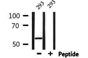Western blot analysis of extracts from 293, using PFKFB1/4 Antibody. (PFKFB1/4 antibody)
