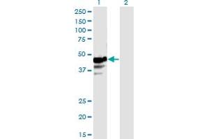 Western Blot analysis of NAPRT1 expression in transfected 293T cell line by NAPRT1 monoclonal antibody (M01), clone 4A9. (NAPRT1 antibody  (AA 1-466))