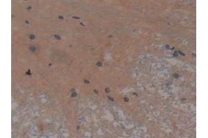 Detection of BFP in Rat Spinal cord Tissue using Polyclonal Antibody to Brain Finger Protein (BFP)