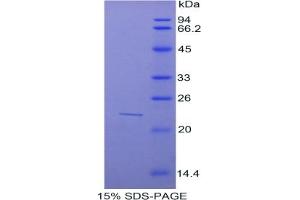 SDS-PAGE of Protein Standard from the Kit (Highly purified E. (SUOX ELISA Kit)