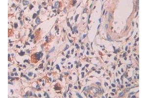 Immunohistochemistry (IHC) image for anti-Amyloid P Component, Serum (APCS) (AA 23-223) antibody (ABIN7438559)
