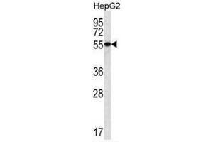 UGDH Antibody (C-term) western blot analysis in HepG2 cell line lysates (35 µg/lane). (UGDH antibody  (C-Term))
