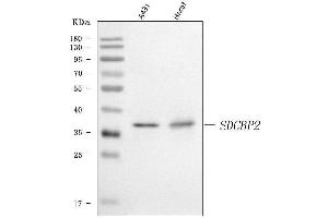Western blot analysis of Syntenin 2/SDCBP2 using anti-Syntenin 2/SDCBP2 antibody (ABIN7600017). (SDCBP2 antibody  (AA 14-292))