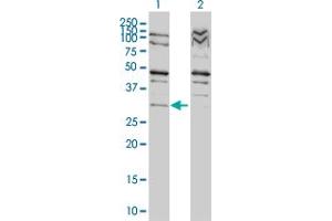 Western Blot analysis of TP53RK expression in transfected 293T cell line by TP53RK monoclonal antibody (M01), clone 4B9-1H3.