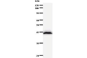 Western Blotting (WB) image for anti-Bromodomain Adjacent To Zinc Finger Domain, 1B (BAZ1B) antibody (ABIN930943) (BAZ1B antibody)