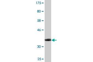 Western Blot detection against Immunogen (36. (Stabilin 1 antibody  (AA 1804-1902))