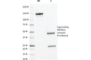 SDS-PAGE Analysis Purified c-Myc Mouse Monoclonal Antibody (9E10. (Myc Tag antibody  (C-Term))