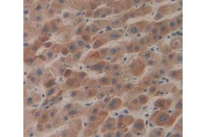 IHC-P analysis of Human Liver Tissue, with DAB staining. (LCAT antibody  (AA 41-210))