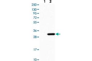 Western blot analysis of Lane 1: Human cell line RT-4 Lane 2: Human cell line U-251MG sp with RPL8 polyclonal antibody  at 1:500-1:1000 dilution.