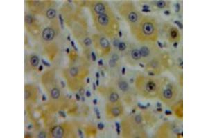 Used in DAB staining on fromalin fixed paraffin-embedded Liver tissue (CENPE antibody  (AA 2450-2590))