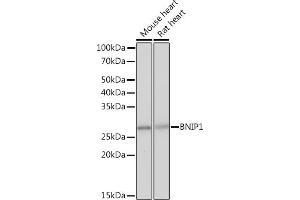 Western blot analysis of extracts of various cell lines, using BNIP1 Rabbit mAb (ABIN7265867) at 1:1000 dilution. (BNIP1 antibody)