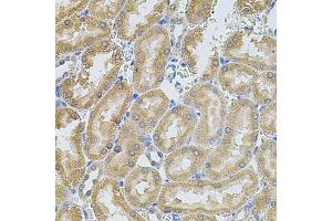 Immunohistochemistry of paraffin-embedded rat kidney using MMP10 antibody (ABIN3017224, ABIN3017225, ABIN3017226 and ABIN6220001) at dilution of 1:100 (40x lens).