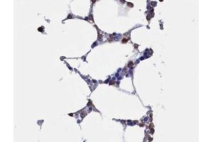ABIN6268734 at 1/100 staining human Bone marrow tissue sections by IHC-P. (RUNX2 antibody  (Internal Region))