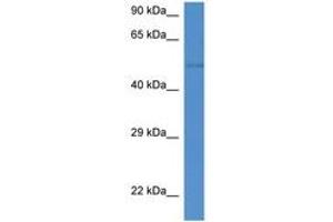 Image no. 1 for anti-ST6 beta-Galactosamide alpha-2,6-Sialyltranferase 2 (ST6GAL2) (AA 286-335) antibody (ABIN6746316) (ST6GAL2 antibody  (AA 286-335))