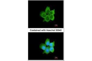 ICC/IF Image Immunofluorescence analysis of paraformaldehyde-fixed A431, using CacyBP, antibody at 1:200 dilution. (CACYBP antibody)