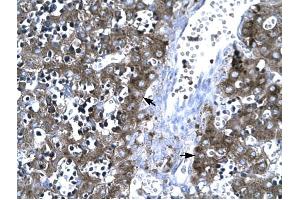 MMP19 antibody was used for immunohistochemistry at a concentration of 4-8 ug/ml to stain Hepatocytes (arrows) in Human Liver.