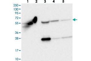 Western blot analysis of Lane 1: RT-4, Lane 2: U-251 MG, Lane 3: Human Plasma, Lane 4: Liver, Lane 5: Tonsil with OTUD1 polyclonal antibody  at 1:250-1:500 dilution.