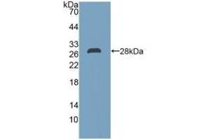 Detection of Recombinant DDAH2, Human using Polyclonal Antibody to Dimethylarginine Dimethylaminohydrolase 2 (DDAH2) (DDAH2 antibody  (AA 31-265))