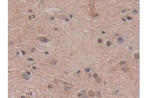 Detection of BCAS3 in Human Cerebrum Tissue using Polyclonal Antibody to Breast Carcinoma Amplified Sequence 3 (BCAS3) (BCAS3 antibody  (AA 230-546))