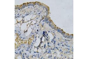 Immunohistochemistry of paraffin-embedded mouse lung using APRT Antibody. (APRT antibody  (AA 1-180))