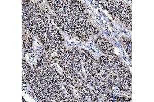 IHC analysis of HNRNPL using anti-HNRNPL antibody (ABIN4886624). (HNRNPL antibody  (C-Term))