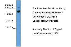 WB Suggested Anti-ALDH3A1  Antibody Titration: 0. (ALDH3A1 antibody  (C-Term))