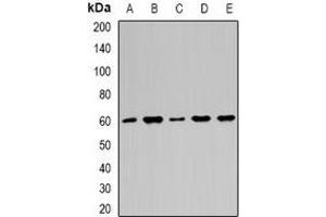Western blot analysis of Importin alpha 1 expression in HepG2 (A), Hela (B), A549 (C), mouse brain (D), mouse heart (E) whole cell lysates.