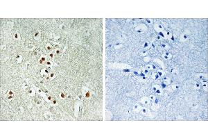 Peptide - +Immunohistochemistry analysis of paraffin-embedded human brain tissue using GADD45GIP1 antibody. (GADD45GIP1 antibody  (Internal Region))
