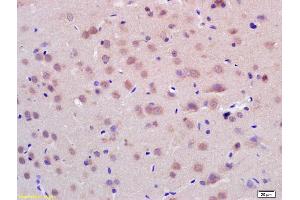 Formalin-fixed and paraffin embedded rat brain labeled with Anti-CHIP Polyclonal Antibody, Unconjugated (ABIN1714131) at 1:200 followed by conjugation to the secondary antibody and DAB staining. (STUB1 antibody  (AA 101-200))