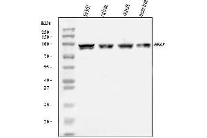 Western blot analysis of B Raf/BRAF using anti-B Raf/BRAF antibody (ABIN3043761).