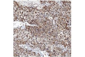 IHC analysis of VAPB using anti-VAPB antibody (ABIN5693292). (VAPB antibody  (AA 2-55))