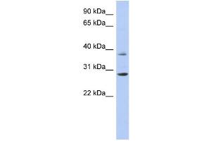 WB Suggested Anti-HOXC5 Antibody Titration:  0. (Homeobox C5 antibody  (Middle Region))