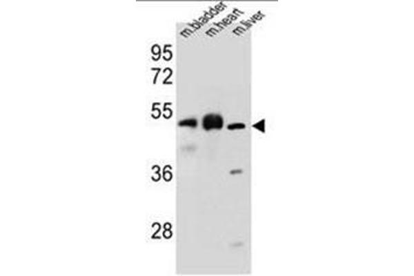 BTBD17 anticorps  (C-Term)