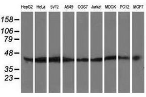 Image no. 2 for anti-ATG3 Autophagy Related 3 (ATG3) antibody (ABIN1496761) (ATG3 antibody)