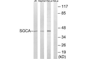 Western Blotting (WB) image for anti-Sarcoglycan, alpha (50kDa Dystrophin-Associated Glycoprotein) (SGCA) (Internal Region) antibody (ABIN1850734) (SGCA antibody  (Internal Region))