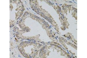 Immunohistochemistry of paraffin-embedded Human prostate using VIP Polyclonal Antibody (Vip antibody)